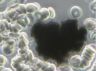 Como remover o óxido de grafeno do corpo?